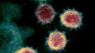 3,538 New COVID-19 Cases, 43 More Virus-Related Deaths Reported In State, Health Officials Say